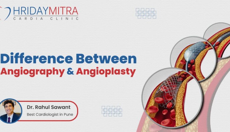 Difference Between Angiography and Angioplasty