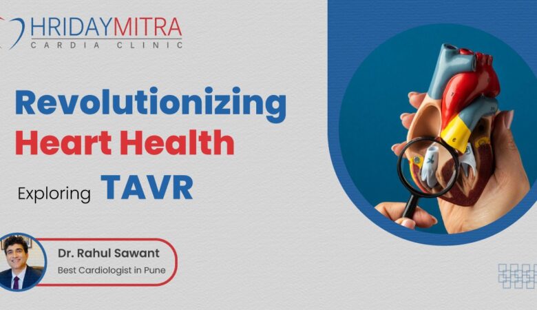 Exploring Transcatheter Aortic Valve Replacement