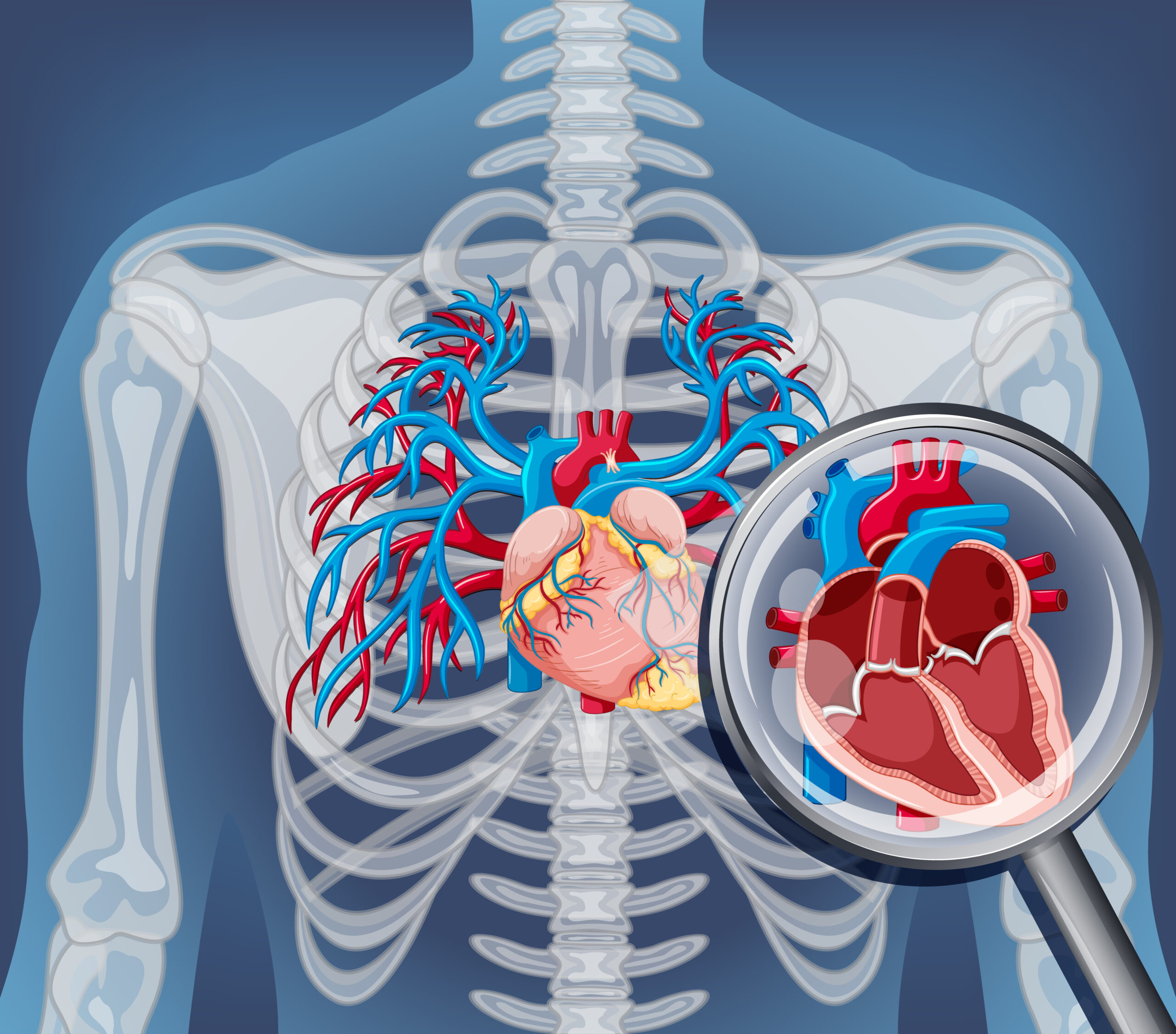 Importance of Coronary Angiography